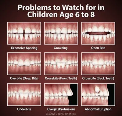 Bite Problems And How To Fix Them
